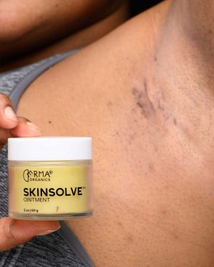 Skinsolve-3