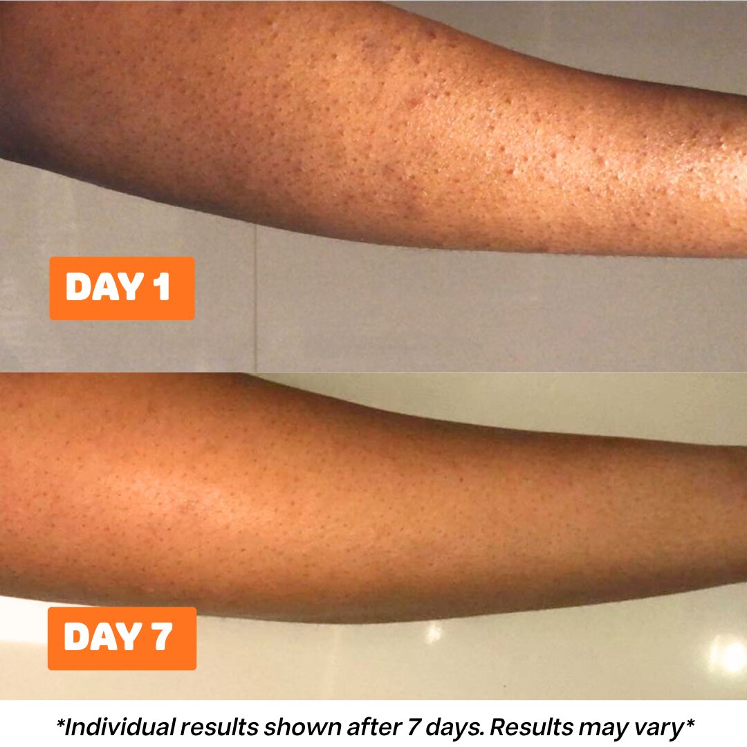 Second image of Bitter Leaf N’ Neem Soap