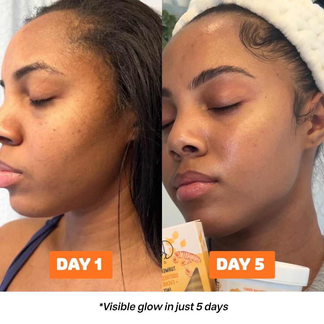 Second image of Wild Turmeric Root Bar