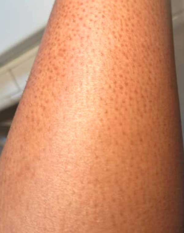 African-Honey-Lemon-Scrub---Now