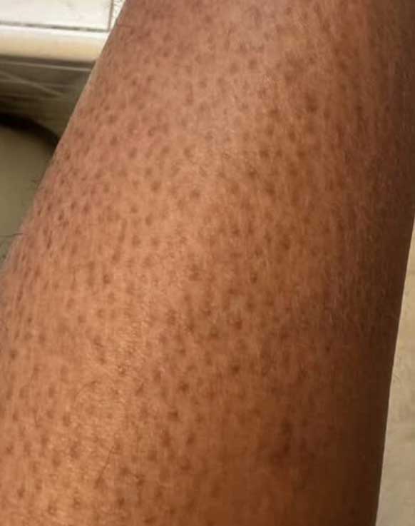 African-Honey-Lemon-Scrub---Then