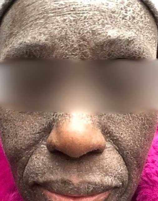 Lemongrass-Body-Buttercream---Before