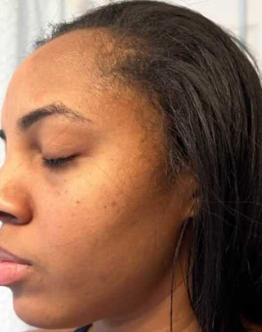 The-Glow-Up-Skin-Kit---Then