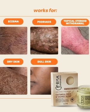 psoriasis-2