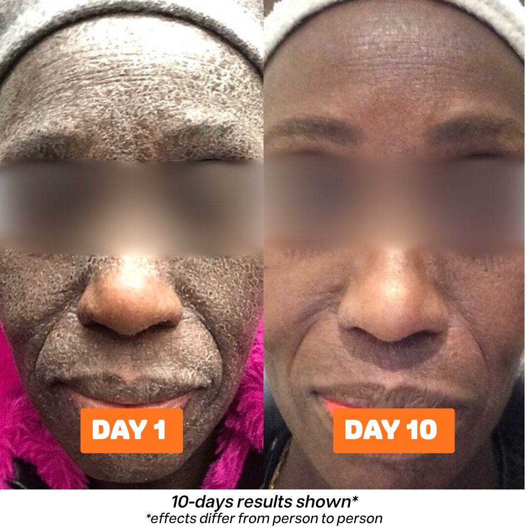 Second image of Skinsolve Ointment™