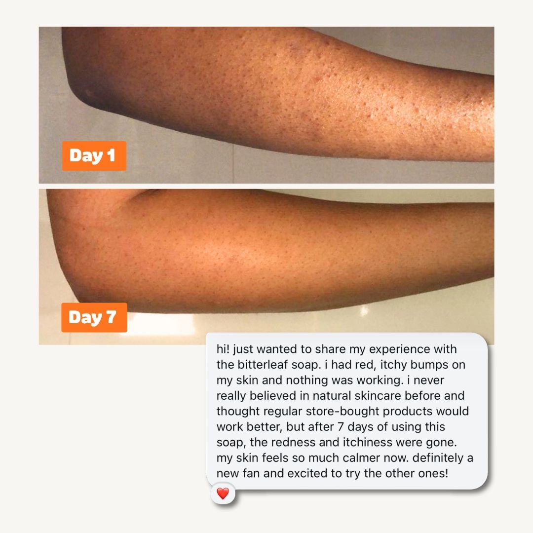 Bitter Leaf n’ Neem Soap