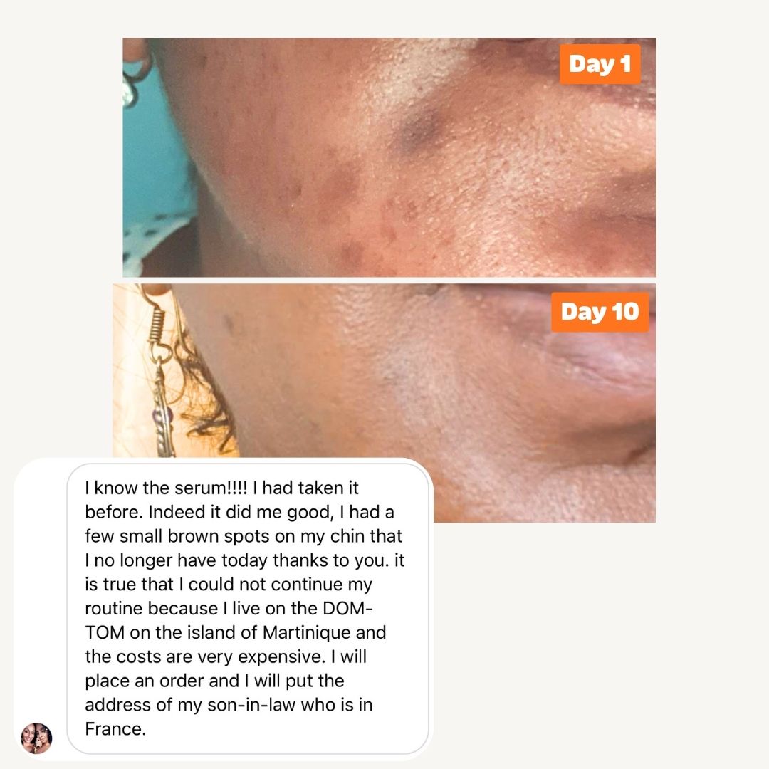 Brightening Equalizer Facial Moisturizer