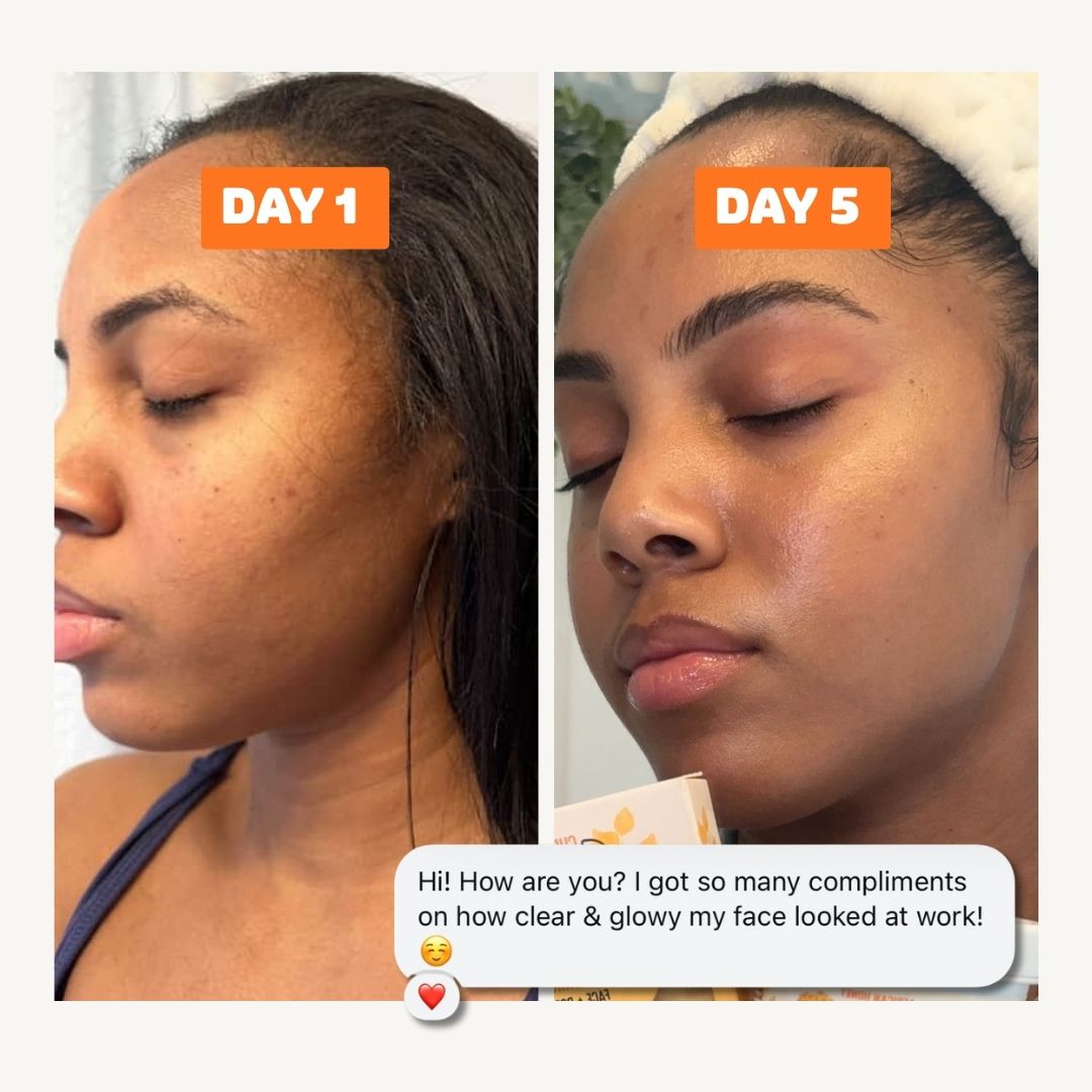 The Glow Up Skin Kit