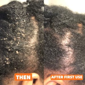 scalp-simulating-grease